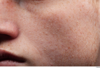 HD Face Skin Fergal cheek face lips mouth skin pores…